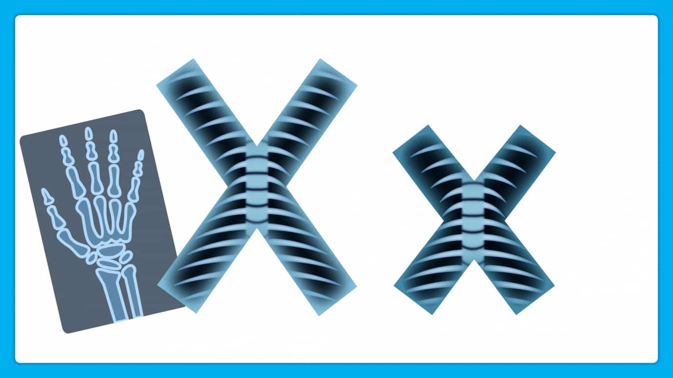 The Letter X